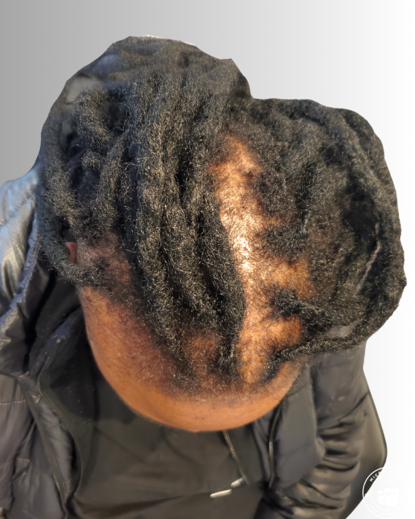 BEST SMP LONG HAIR